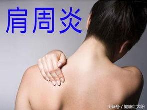 吃瓜会肩膀疼痛吗